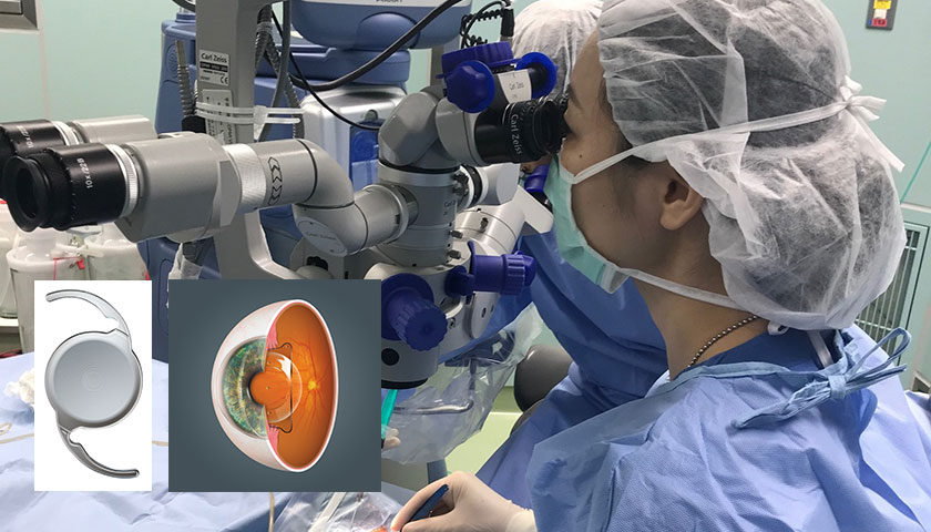 屈折矯正部門のご紹介