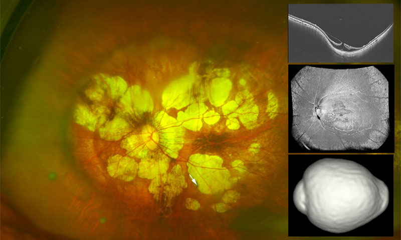 病的近視部門のご紹介